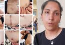 Maestra de Alderetes que sobrevivió a 15 puñaladas volvió a su casa, se encontró con el vecino que la había atacado y él se burló de sus heridas