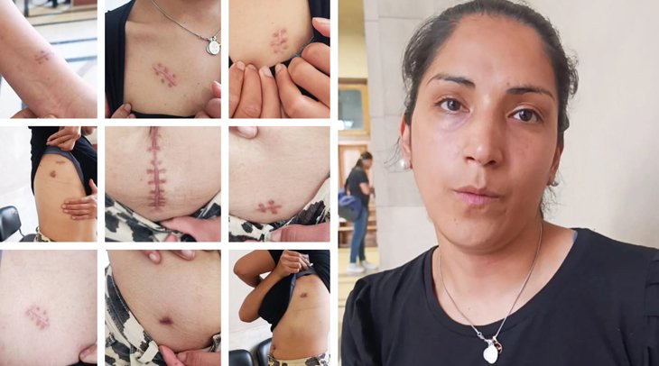 Maestra de Alderetes que sobrevivió a 15 puñaladas volvió a su casa, se encontró con el vecino que la había atacado y él se burló de sus heridas